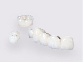 烤瓷牙選多少錢(qián)一顆的合適