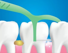 口腔問題可能要“命”！5大預(yù)警信號，別忽視