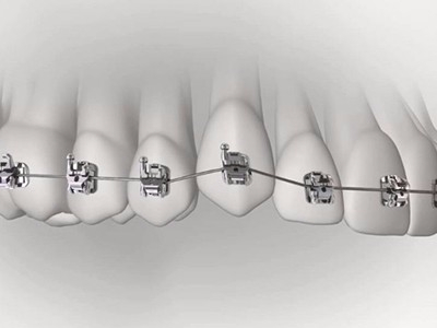 承德市哪家口腔醫(yī)院口腔正畸做得好？惟德口腔醫(yī)院來告訴您