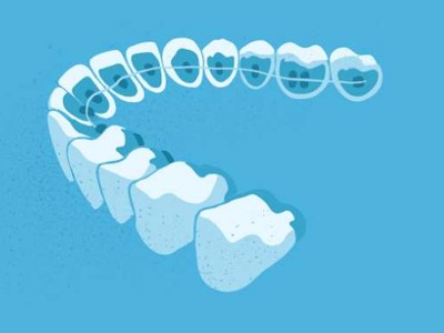 惟德口腔醫(yī)院口腔正畸好不好？