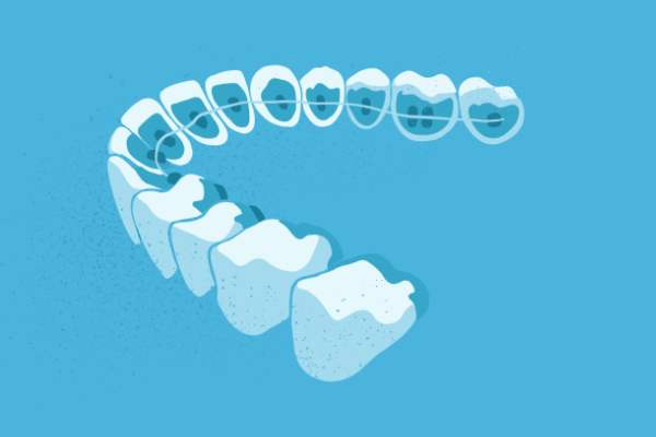 惟德口腔醫(yī)院口腔正畸好不好？